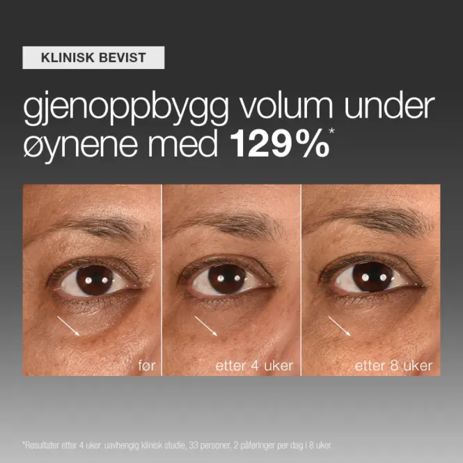 Hovedbilde Smart Eye Density 15ml