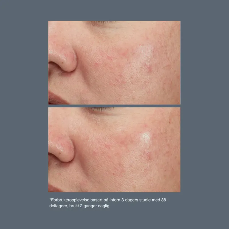 Magnetic [+] afterglow cleanser rens